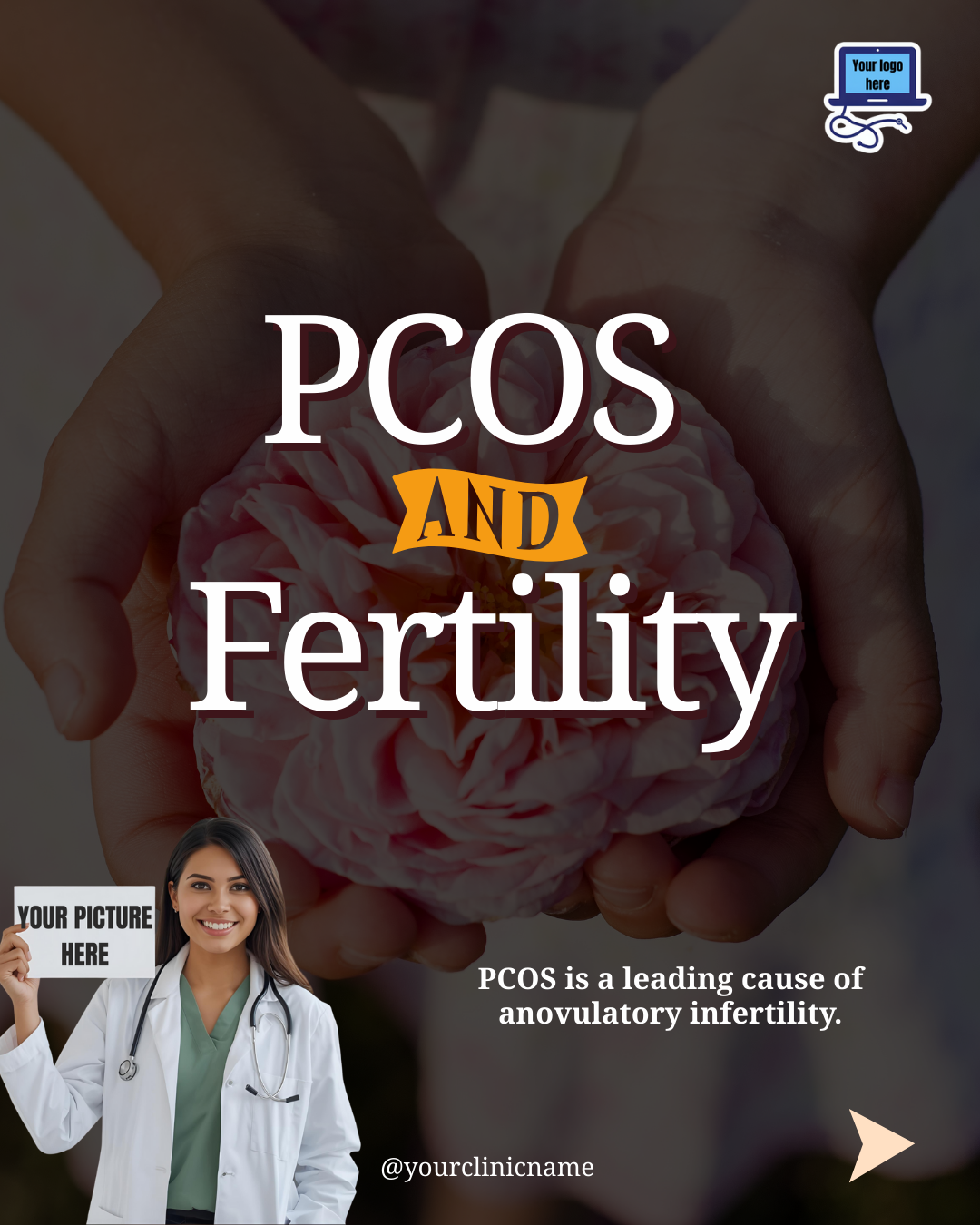 PCOS and Fertility